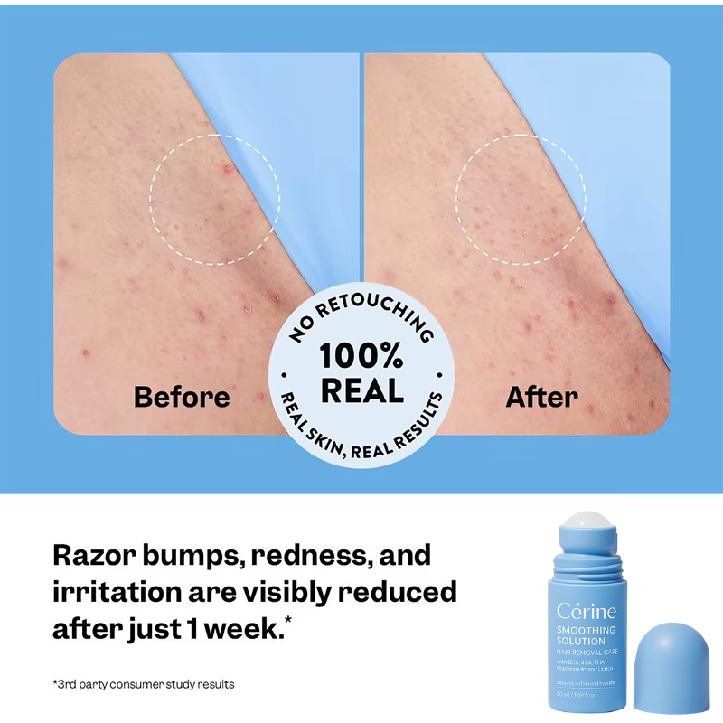 Hair Removal Smoothing Solution
